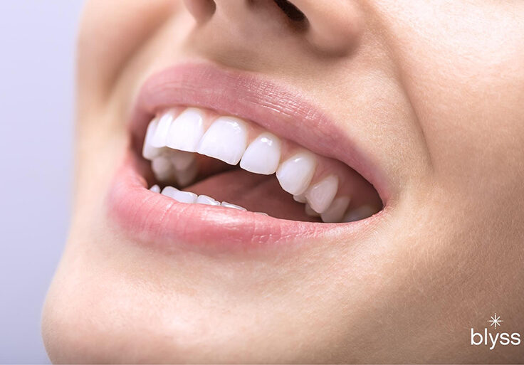 blyss-dental-teeth-whitening-hero-image