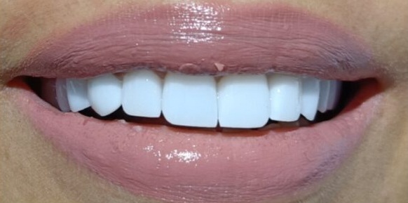 CamScanner 11-04-2025 11.38