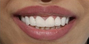 حالة واحد بعد